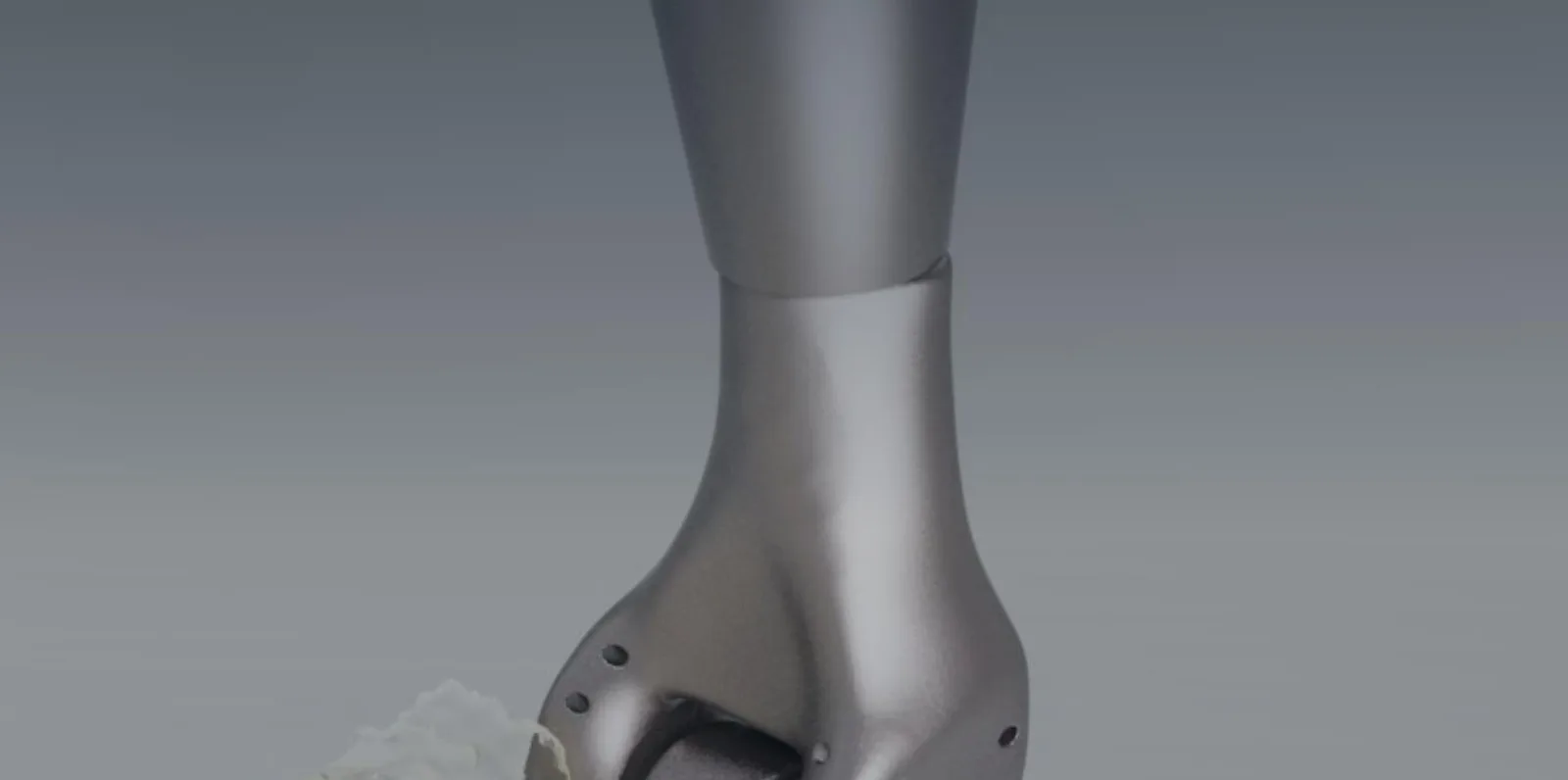Patient-specific Ti6Al4V titanium elbow joint reconstruction